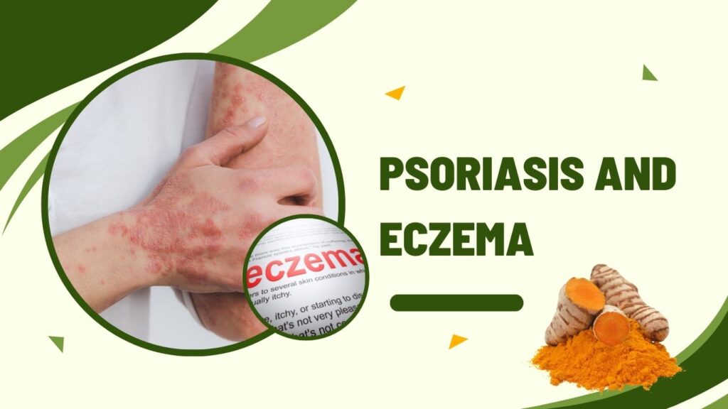 Psoriasis And Eczema 1024x576